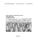 ANTISENSE OLIGONUCLEOTIDES AGAINST ACETYLCHOLINESTERASE FOR TREATING     INFLAMMATORY DISEASES diagram and image