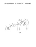 DETECTION OF WAVEFORM ARTIFACT diagram and image