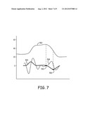 DETECTION OF WAVEFORM ARTIFACT diagram and image