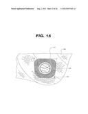 APPARATUS AND METHOD FOR MOUNTING A THERAPEUTIC DEVICE diagram and image