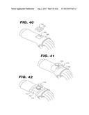 APPARATUS AND METHOD FOR MOUNTING A THERAPEUTIC DEVICE diagram and image