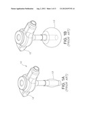 Inflatable Retention System for Enteral Feeding Device diagram and image