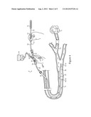 Catheter Assembly And Method diagram and image