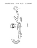 Catheter Assembly And Method diagram and image