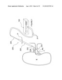 APPARATUSES FOR RENAL NEUROMODULATION diagram and image