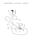 APPARATUSES FOR RENAL NEUROMODULATION diagram and image