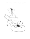 APPARATUSES FOR RENAL NEUROMODULATION diagram and image