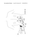 APPARATUSES FOR RENAL NEUROMODULATION diagram and image