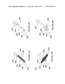 APPARATUSES FOR RENAL NEUROMODULATION diagram and image