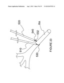 APPARATUSES FOR RENAL NEUROMODULATION diagram and image