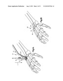 REAMER GUIDE SYSTEMS AND METHODS OF USE diagram and image