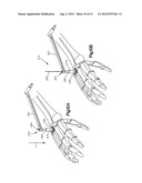 REAMER GUIDE SYSTEMS AND METHODS OF USE diagram and image