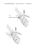 REAMER GUIDE SYSTEMS AND METHODS OF USE diagram and image