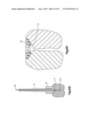 REAMER GUIDE SYSTEMS AND METHODS OF USE diagram and image