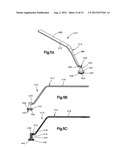 REAMER GUIDE SYSTEMS AND METHODS OF USE diagram and image