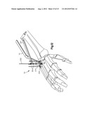 REAMER GUIDE SYSTEMS AND METHODS OF USE diagram and image