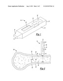 Method and Apparatus for Aligning Bone Screw Holes diagram and image