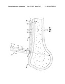 Method and Apparatus for Aligning Bone Screw Holes diagram and image