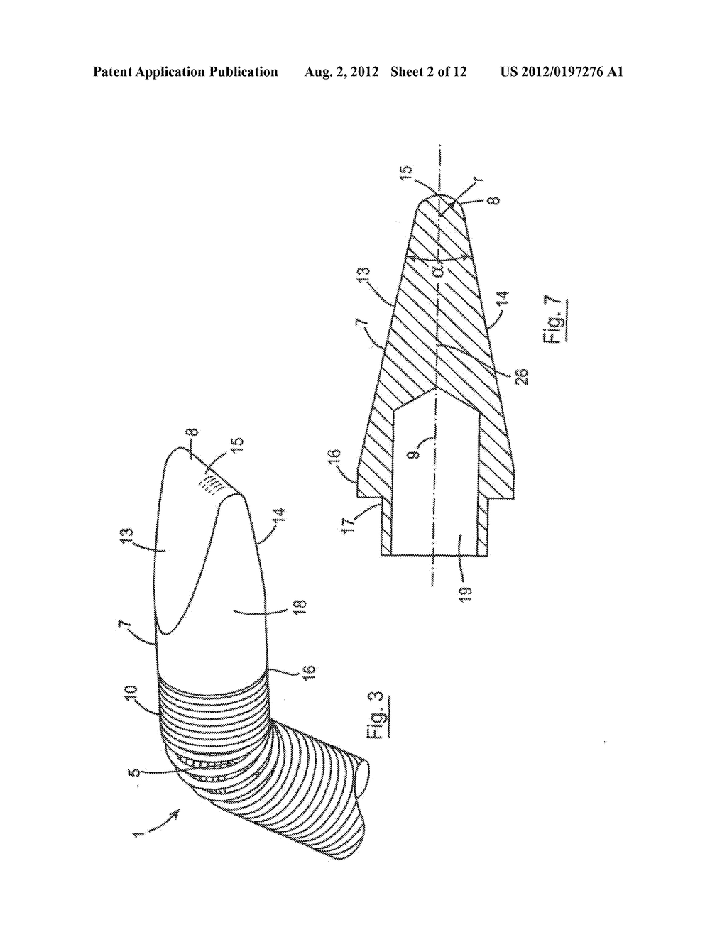 GUIDE WIRE FOR USE IN RE-CANALISING A VASCULAR OCCLUSION IN A HUMAN OR     ANIMAL SUBJECT - diagram, schematic, and image 03