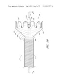 VASCULAR PLAQUE REMOVAL SYSTEMS, DEVICES, AND METHODS diagram and image