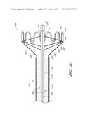 VASCULAR PLAQUE REMOVAL SYSTEMS, DEVICES, AND METHODS diagram and image