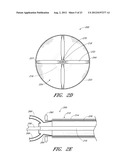 VASCULAR PLAQUE REMOVAL SYSTEMS, DEVICES, AND METHODS diagram and image