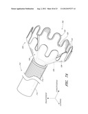 VASCULAR PLAQUE REMOVAL SYSTEMS, DEVICES, AND METHODS diagram and image