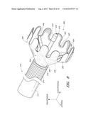 VASCULAR PLAQUE REMOVAL SYSTEMS, DEVICES, AND METHODS diagram and image