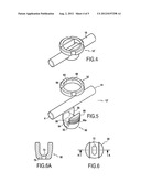 VERTEBRAL FIXING SYSTEM diagram and image