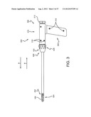 SPINE SURGERY METHOD AND IMPLANT DEPLOYMENT diagram and image