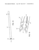 SPINE SURGERY METHOD AND IMPLANT DEPLOYMENT diagram and image