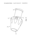 SPINE SURGERY METHOD AND IMPLANT DEPLOYMENT diagram and image