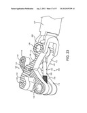 SPINE SURGERY METHOD AND IMPLANT DEPLOYMENT diagram and image