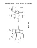 SPINE SURGERY METHOD AND IMPLANT DEPLOYMENT diagram and image