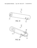 SPINE SURGERY METHOD AND IMPLANT DEPLOYMENT diagram and image