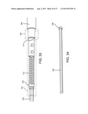 SPINE SURGERY METHOD AND IMPLANT DEPLOYMENT diagram and image