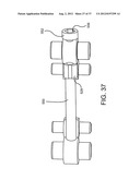 SPINE SURGERY METHOD AND IMPLANT DEPLOYMENT diagram and image