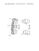 SPINE SURGERY METHOD AND IMPLANT DEPLOYMENT diagram and image