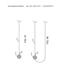 SPINE SURGERY METHOD AND IMPLANT DEPLOYMENT diagram and image