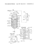 MINIMALLY INVASIVE SPINAL FACET COMPRESSION SCREW AND SYSTEM FOR BONE     JOINT FUSION AND FIXATION diagram and image