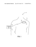 COMMUNICATION DIPOLE FOR IMPLANTABLE MEDICAL DEVICE diagram and image