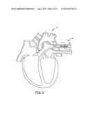 COMMUNICATION DIPOLE FOR IMPLANTABLE MEDICAL DEVICE diagram and image