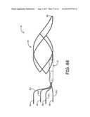 COMMUNICATION DIPOLE FOR IMPLANTABLE MEDICAL DEVICE diagram and image