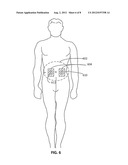 Light Therapy for Treating or Managing Diabetes and Metabolic Syndrome diagram and image