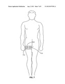 Light Therapy for Treating or Managing Diabetes and Metabolic Syndrome diagram and image