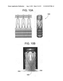 Stent-Valves for Valve Replacement and Associated Methods and Systems for     Surgery diagram and image