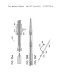 Stent-Valves for Valve Replacement and Associated Methods and Systems for     Surgery diagram and image