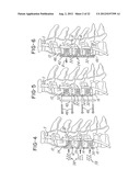 INTERVERTEBRAL FUSTION DEVICE UTILIZING MULTIPLE MOBILE UNIAXIAL AND     BIDIRECTIONAL SCREW INTERFACE PLATES diagram and image