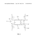 INTERVERTEBRAL IMPLANT WITH ROTATING MEMBER diagram and image