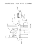 FORCE SENSING ORAL CARE INSTRUMENT diagram and image